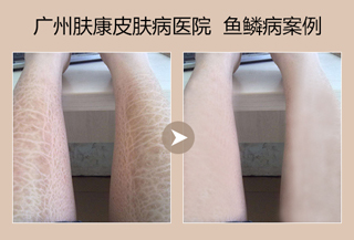 ���ݷ���Ƥ����ҽԺ