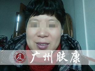 ���ݷ���Ƥ����ҽԺ