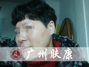 ���ݷ���Ƥ����ҽԺ