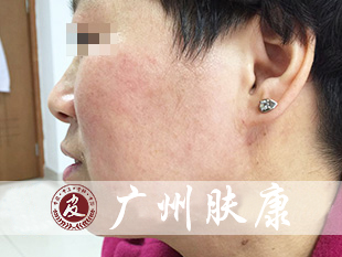 ���ݷ���Ƥ����ҽԺ