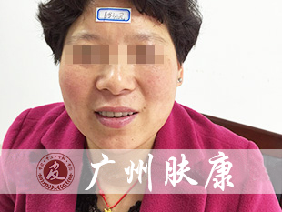 ���ݷ���Ƥ����ҽԺ