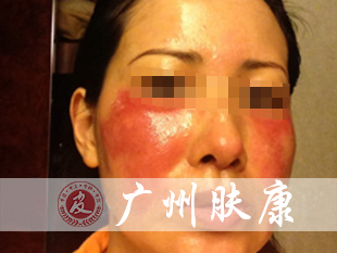 ���ݷ���Ƥ����ҽԺ