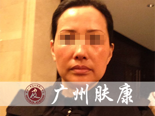 ���ݷ���Ƥ����ҽԺ