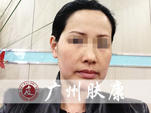 ���ݷ���Ƥ����ҽԺ