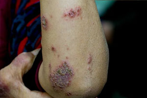 ���ݷ���Ƥ����ҽԺ