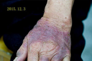 ���ݷ���Ƥ����ҽԺ