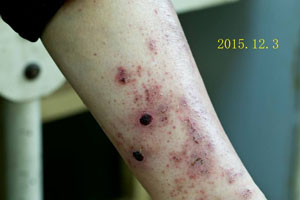 ���ݷ���Ƥ����ҽԺ