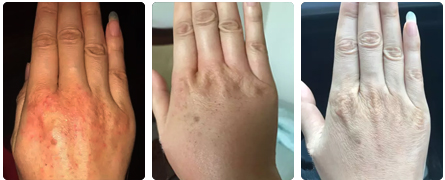 ���ݷ���Ƥ����ҽԺ