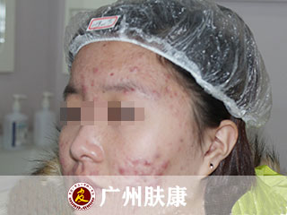 ���ݷ���Ƥ����ҽԺ