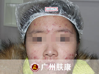 ���ݷ���Ƥ����ҽԺ