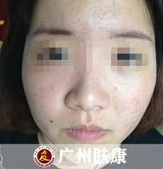 ���ݷ���Ƥ����ҽԺ