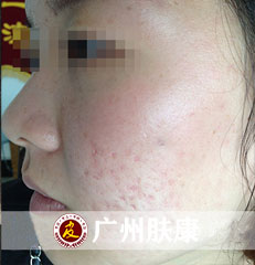 ���ݷ���Ƥ����ҽԺ