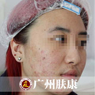 ���ݷ���Ƥ����ҽԺ