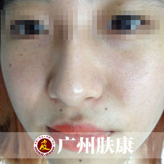 ���ݷ���Ƥ����ҽԺ