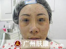 ���ݷ���Ƥ����ҽԺ