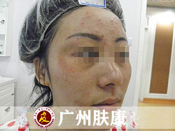 ���ݷ���Ƥ����ҽԺ