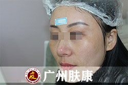 ���ݷ���Ƥ����ҽԺ