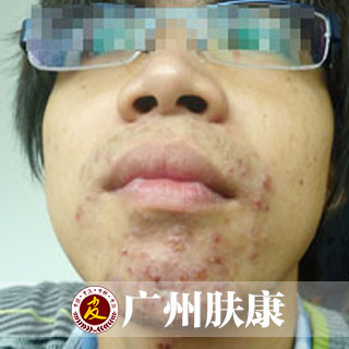 ���ݷ���Ƥ����ҽԺ