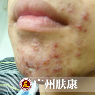 ���ݷ���Ƥ����ҽԺ