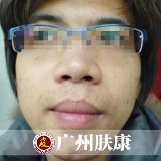 ���ݷ���Ƥ����ҽԺ