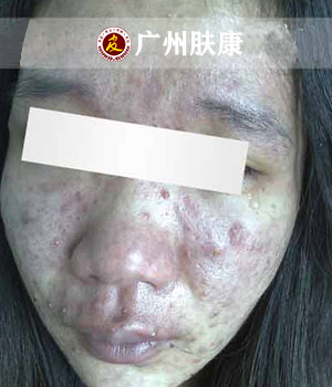 ���ݷ���Ƥ����ҽԺ