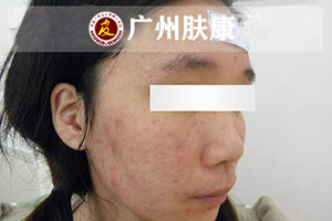 ���ݷ���Ƥ����ҽԺ