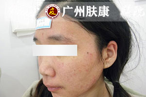 ���ݷ���Ƥ����ҽԺ