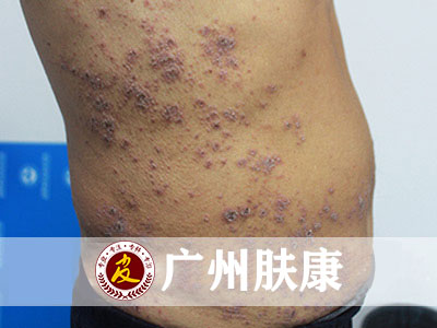 ���ݷ���Ƥ����ҽԺ