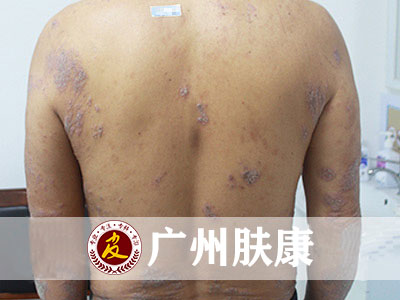 ���ݷ���Ƥ����ҽԺ