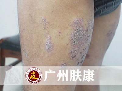 ���ݷ���Ƥ����ҽԺ