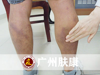 ���ݷ���Ƥ����ҽԺ