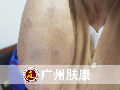 ���ݷ���Ƥ����ҽԺ