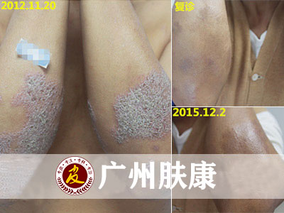 ���ݷ���Ƥ����ҽԺ