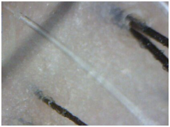 ���ݷ���Ƥ����ҽԺ