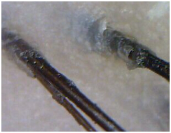 ���ݷ���Ƥ����ҽԺ