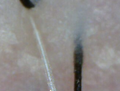 ���ݷ���Ƥ����ҽԺ