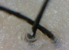 ���ݷ���Ƥ����ҽԺ