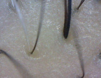 ���ݷ���Ƥ����ҽԺ