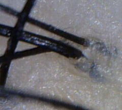 ���ݷ���Ƥ����ҽԺ