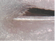 ���ݷ���Ƥ����ҽԺ