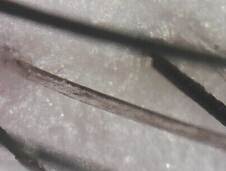 ���ݷ���Ƥ����ҽԺ