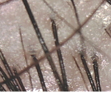 ���ݷ���Ƥ����ҽԺ