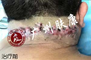 ���ݷ���Ƥ����ҽԺ