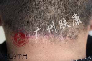 ���ݷ���Ƥ����ҽԺ