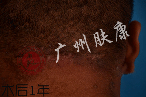 ���ݷ���Ƥ����ҽԺ