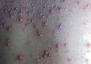 ���ݷ���Ƥ����ҽԺ