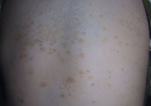 ���ݷ���Ƥ����ҽԺ