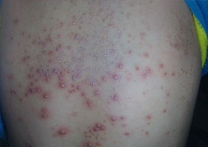 ���ݷ���Ƥ����ҽԺ