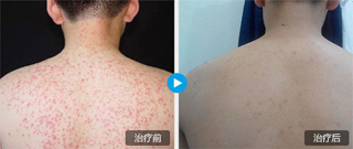 ���ݷ���Ƥ����ҽԺ