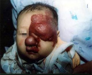 ���ݷ���Ƥ����ҽԺ